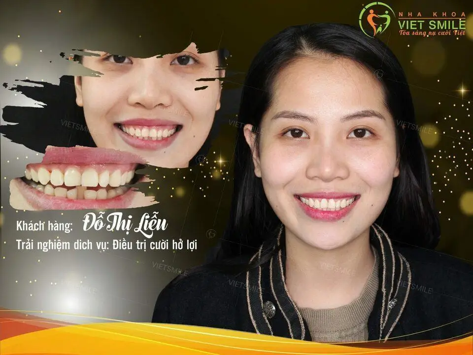 cat loi tham my