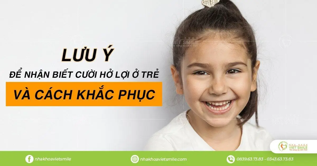  nhận biết cười hở lợi ở trẻ 