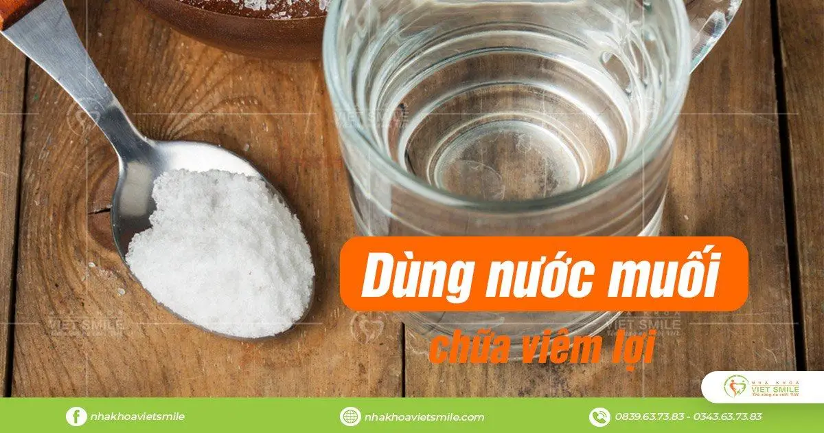 chữa viêm lợi