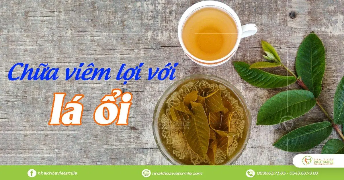 chữa viêm nướu