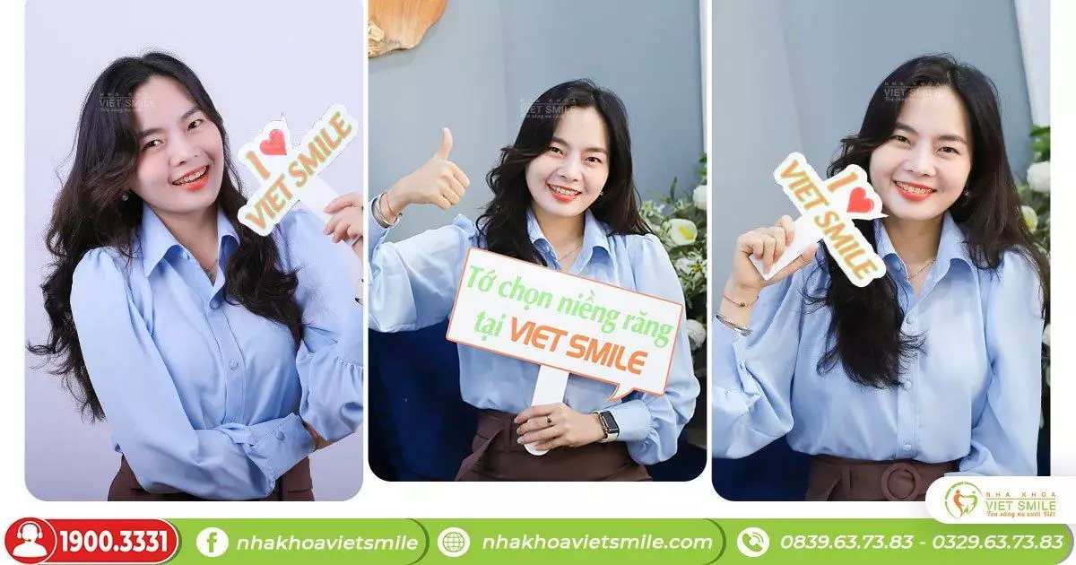 Niềng răng với mắc cài pha lê trong suốt