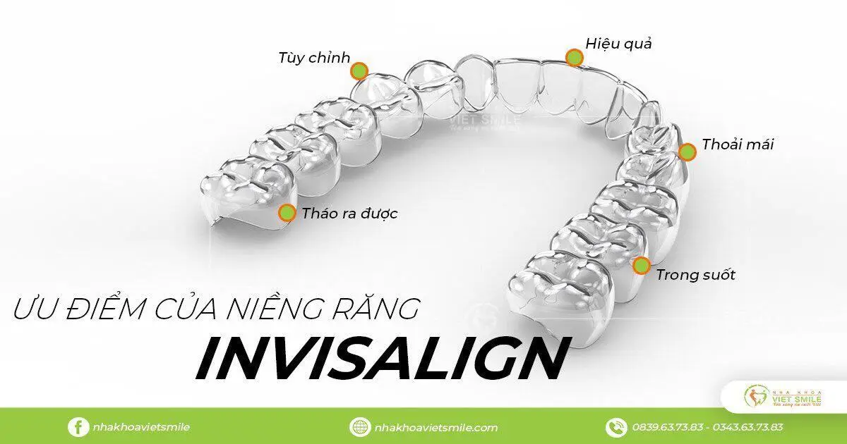 Ưu điểm của niềng răng Invisalign