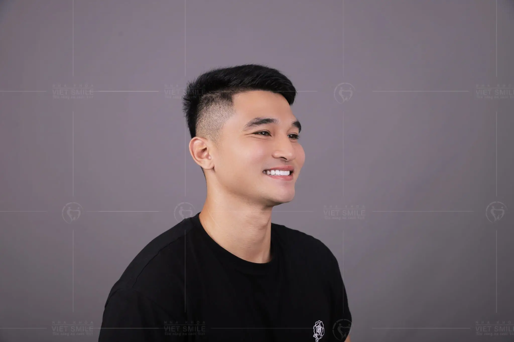 6 thông tin không thể bỏ qua trước khi làm răng sứ