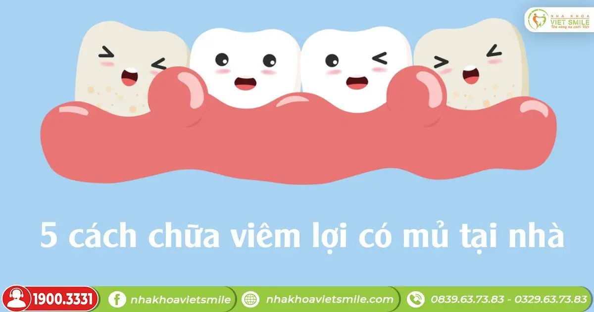 5 cách chữa viêm lợi có mủ tại nhà