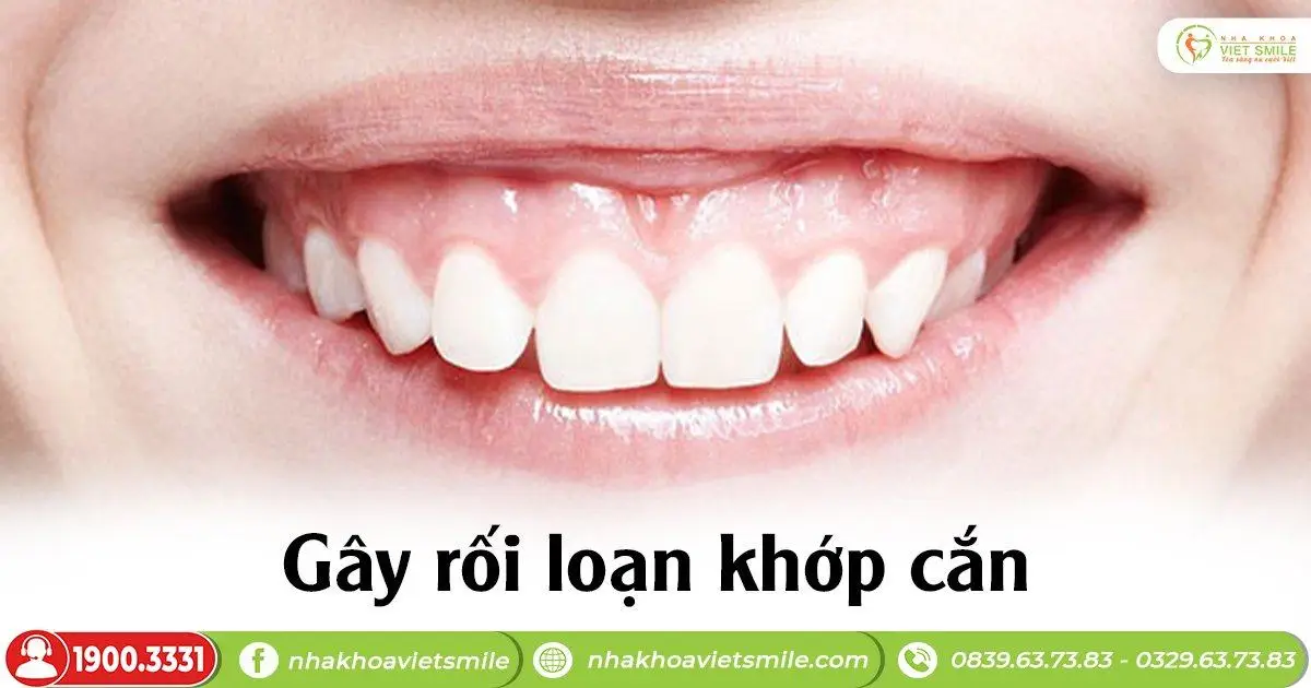 Gây rối loạn khớp cắn