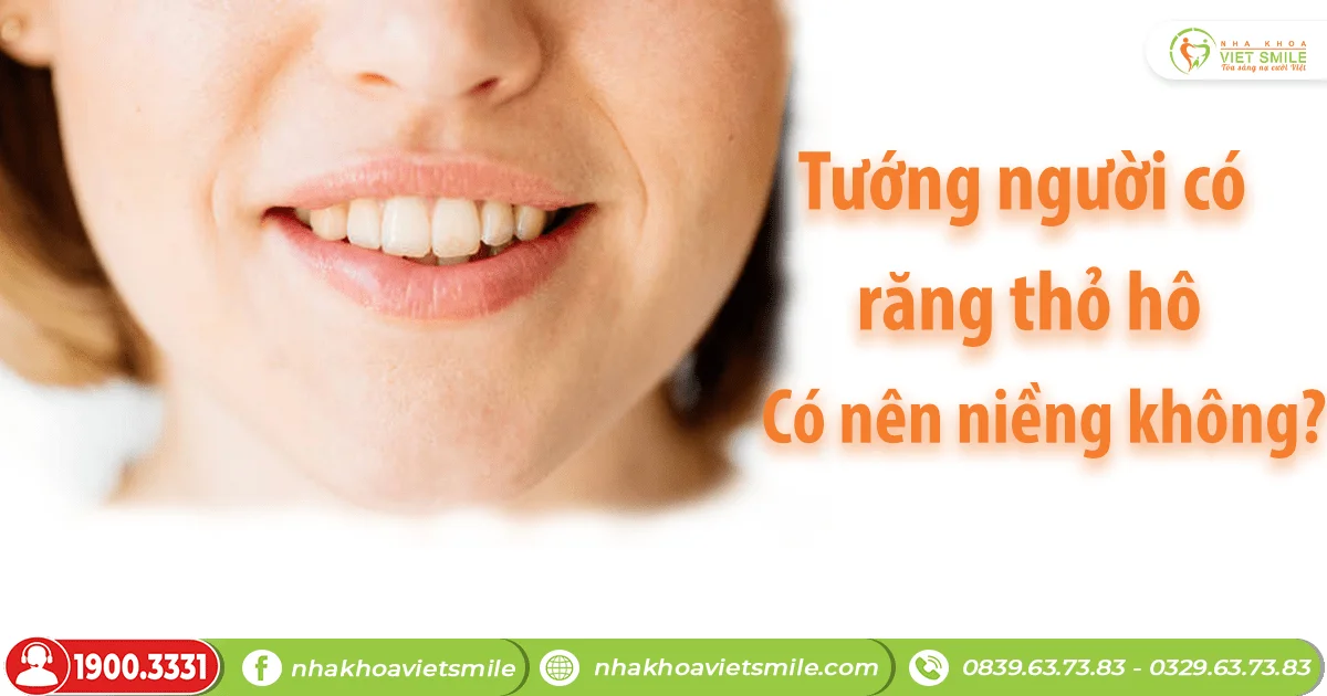 Răng thỏ hô có nên niềng răng không?