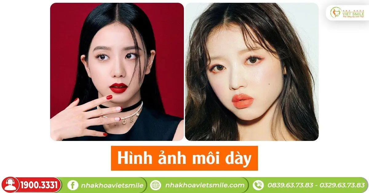 môi dày thì sao
