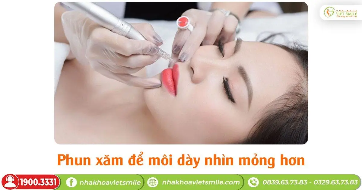 môi dày được chỉnh lại
