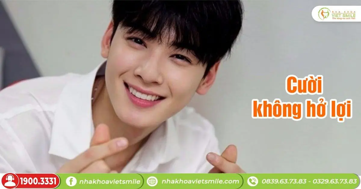 Cười không hở lợi