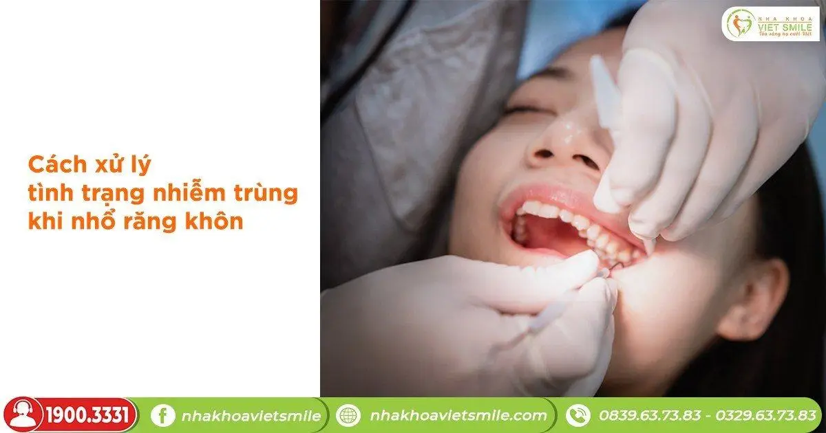 Cách xử lý tình trạng nhiễm trùng khi nhổ răng khôn