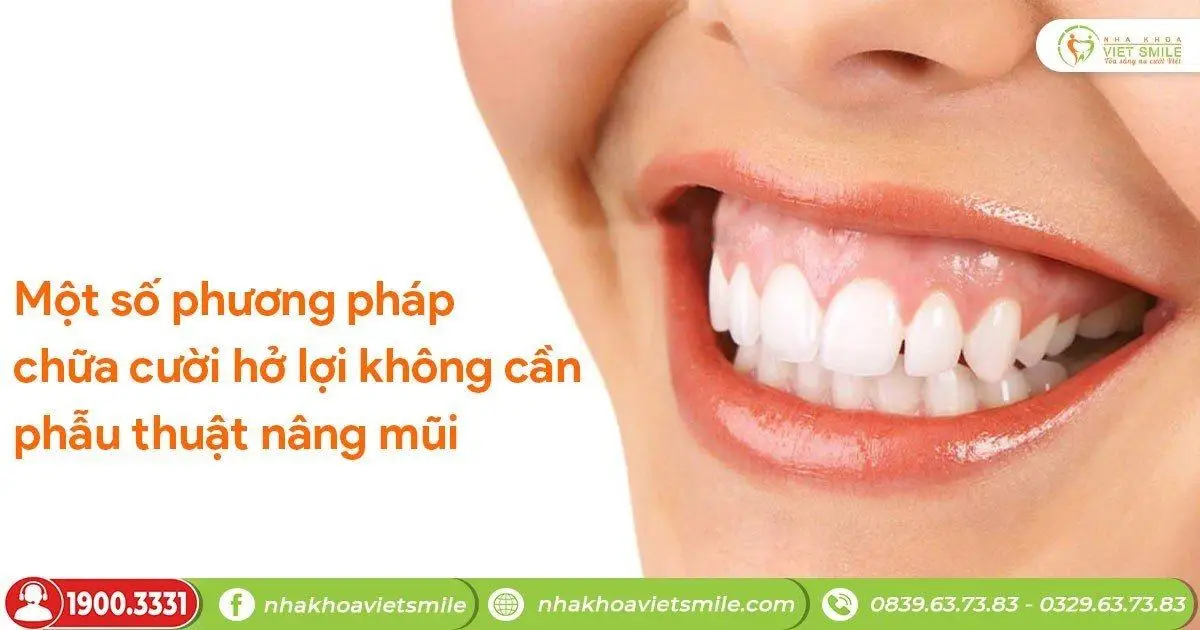 Một số phương pháp chữa cười hở lợi không cần phẫu thuật nâng mũi