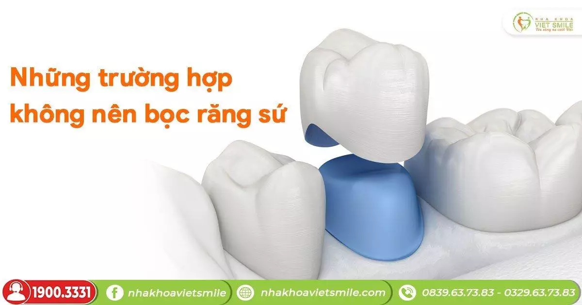 Những trường hợp không nên bọc răng sứ