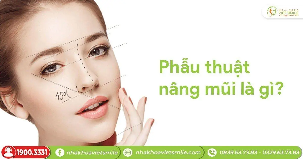 Phẫu thuật nâng mũi là gì?