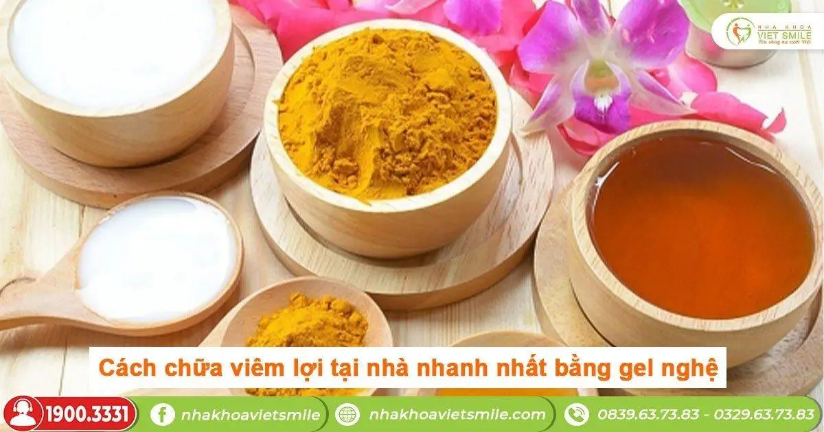 Chữa viêm lợi tại nhà nhanh nhất bằng gel nghệ 