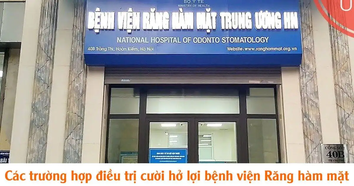 Các trường hợp điều trị cười hở lợi bệnh viện Răng hàm mặt