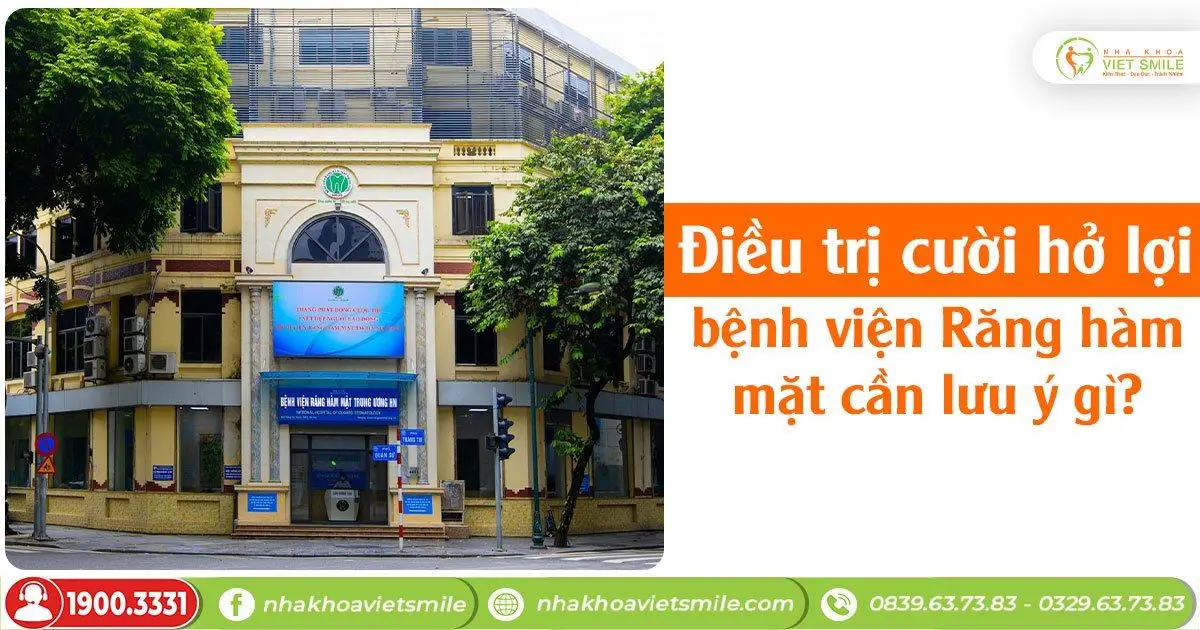 Điều trị cười hở lợi bệnh viện Răng hàm mặt cần lưu ý gì?