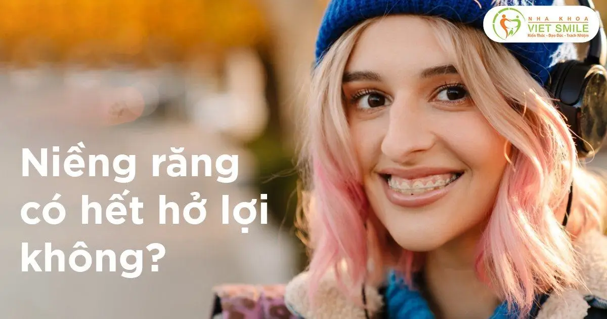 Niềng răng có hết hở lợi không?