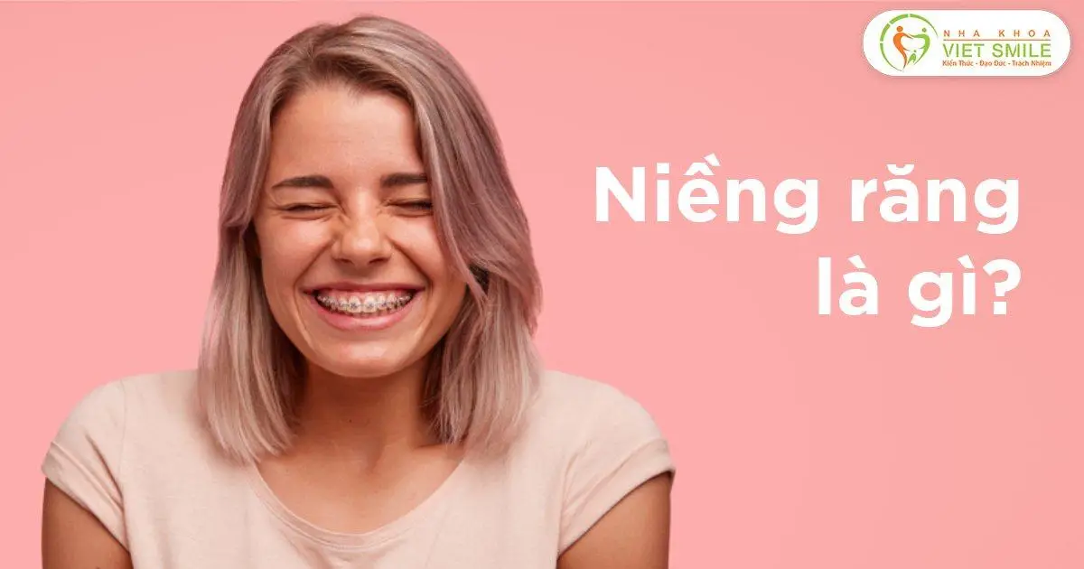 Niềng răng là gì?
