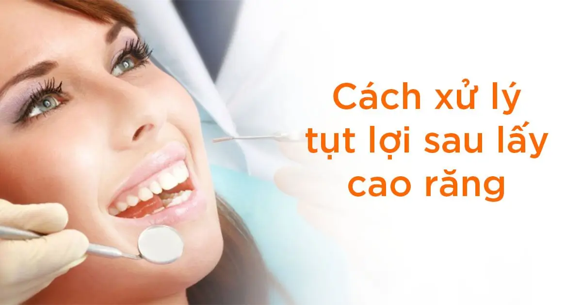 Cách xử lý tụt lợi sau lấy cao răng