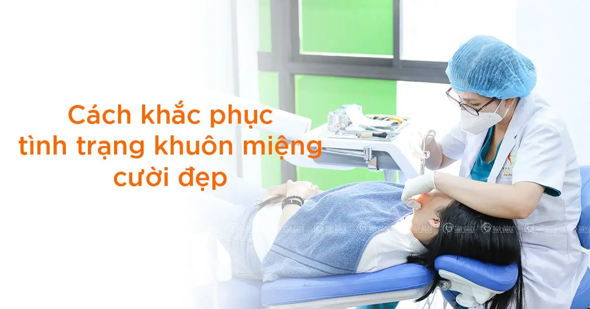 Niềng răng tại nha khoa Viet Smile cải thiện tình trạng khuôn miệng cười không đẹp