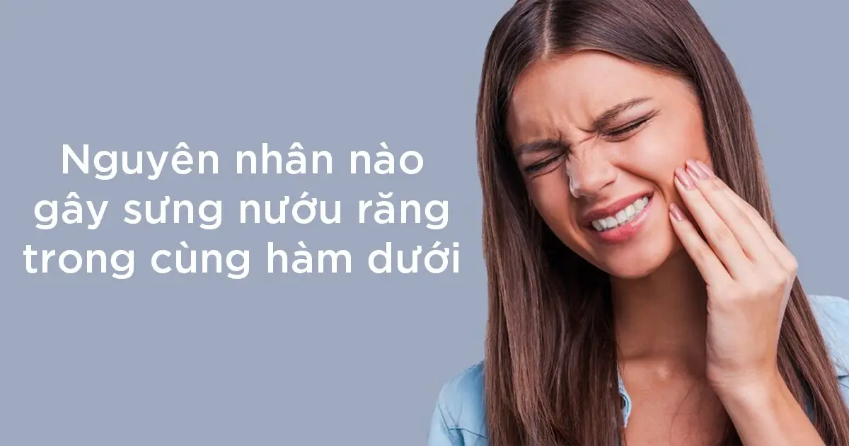 Nguyên nhân nào gây sưng nướu răng trong cùng hàm dưới