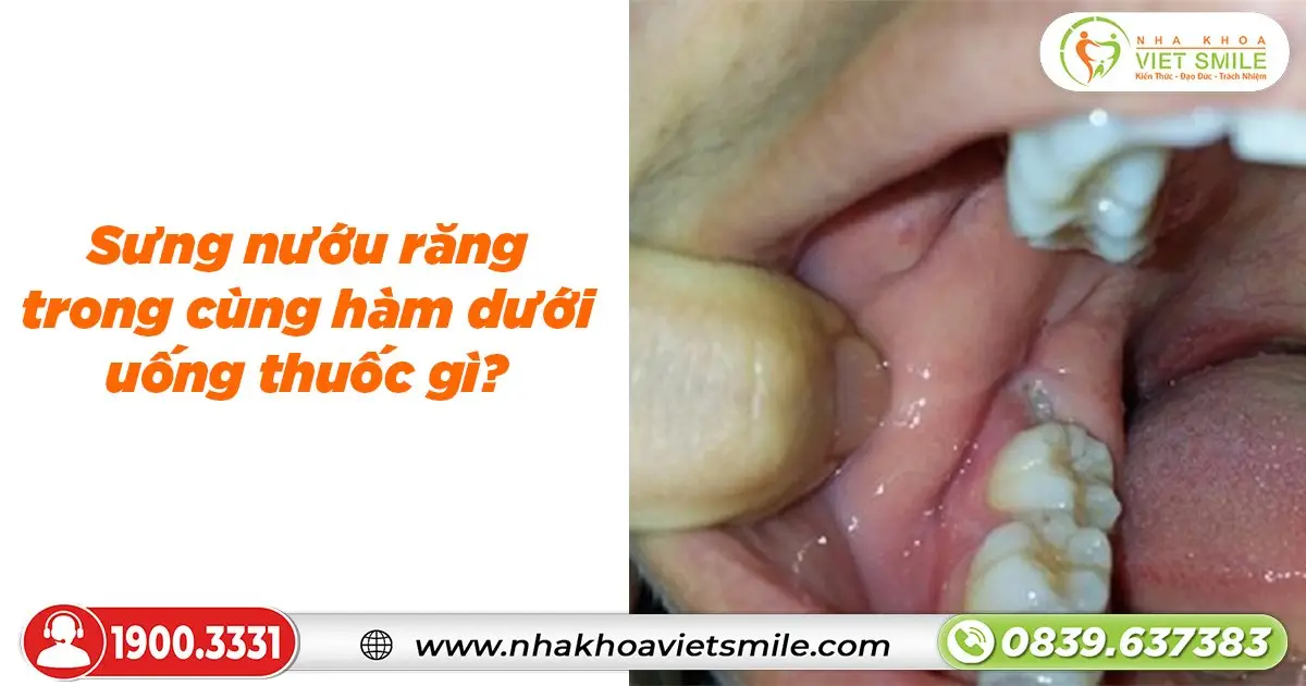 Sưng nướu răng trong cùng hàm dưới uống thuốc gì hiệu quả?