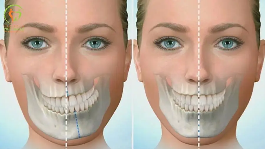 Cấu trúc hàm răng dị dạng gây cười méo miệng