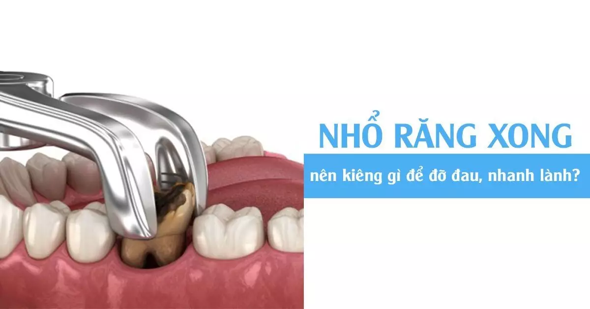 Nhổ răng lúc nào tốt, kiêng gì?