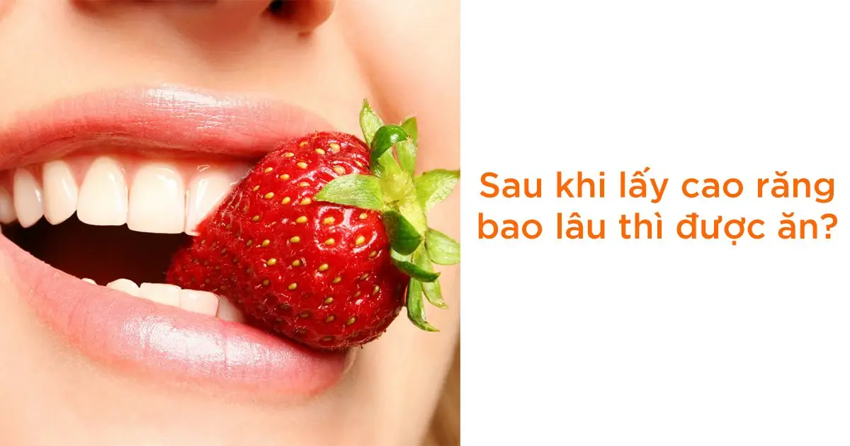 Sau khi lấy cao răng bao lâu thì được ăn?