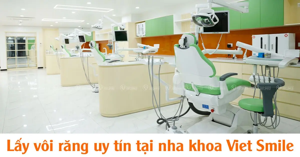 Lấy vôi răng uy tín tại nha khoa Viet Smile 