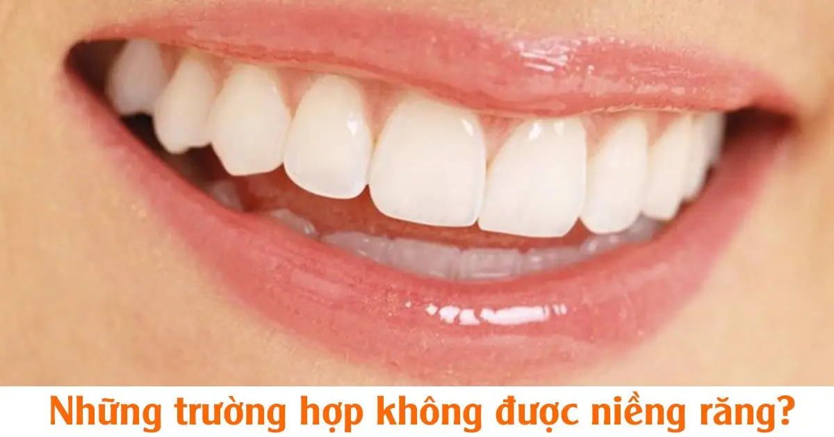 Những trường hợp không được niềng răng?