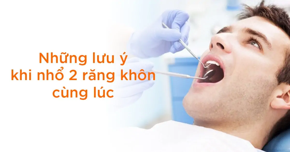 Những lưu ý khi nhổ 2 răng khôn cùng lúc
