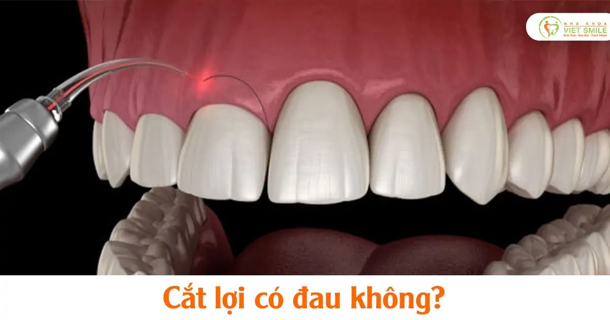 Cắt lợi có đau không?
