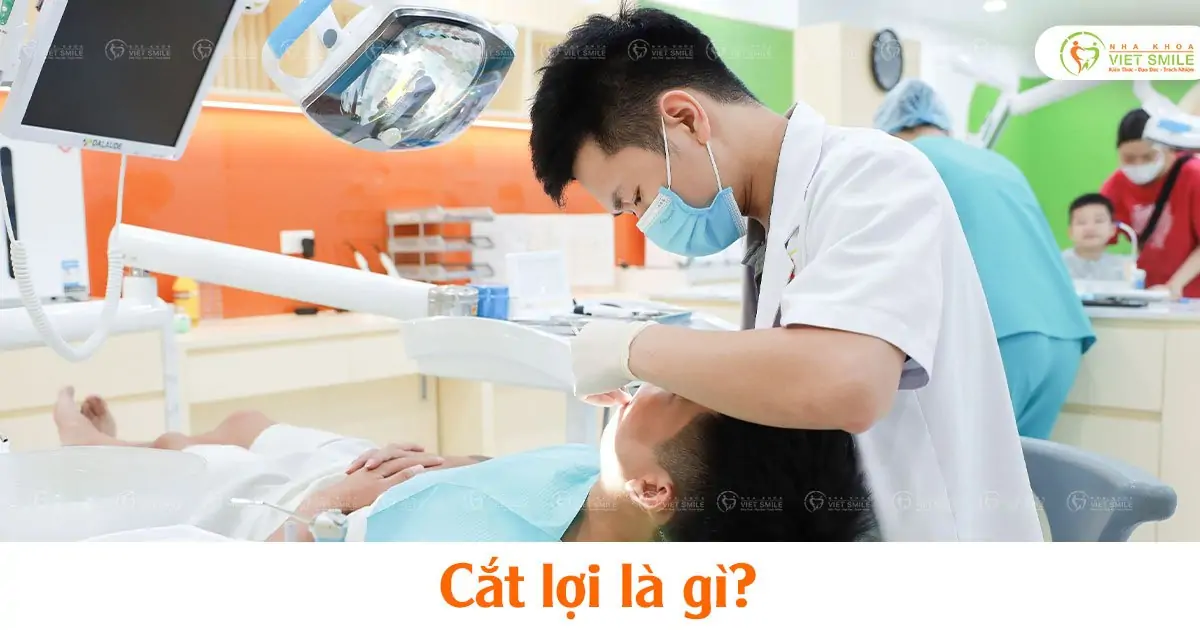 Cắt lợi là gì?