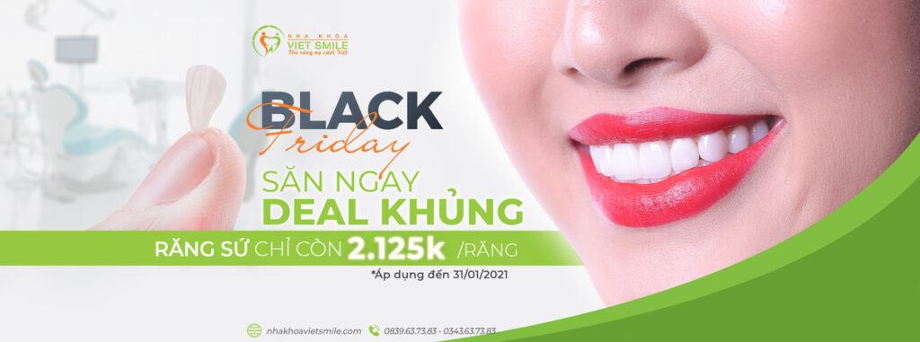 VietSmile Trị Cười Hở Lợi
