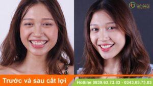 Vietsmile thay doi sau cat loi
