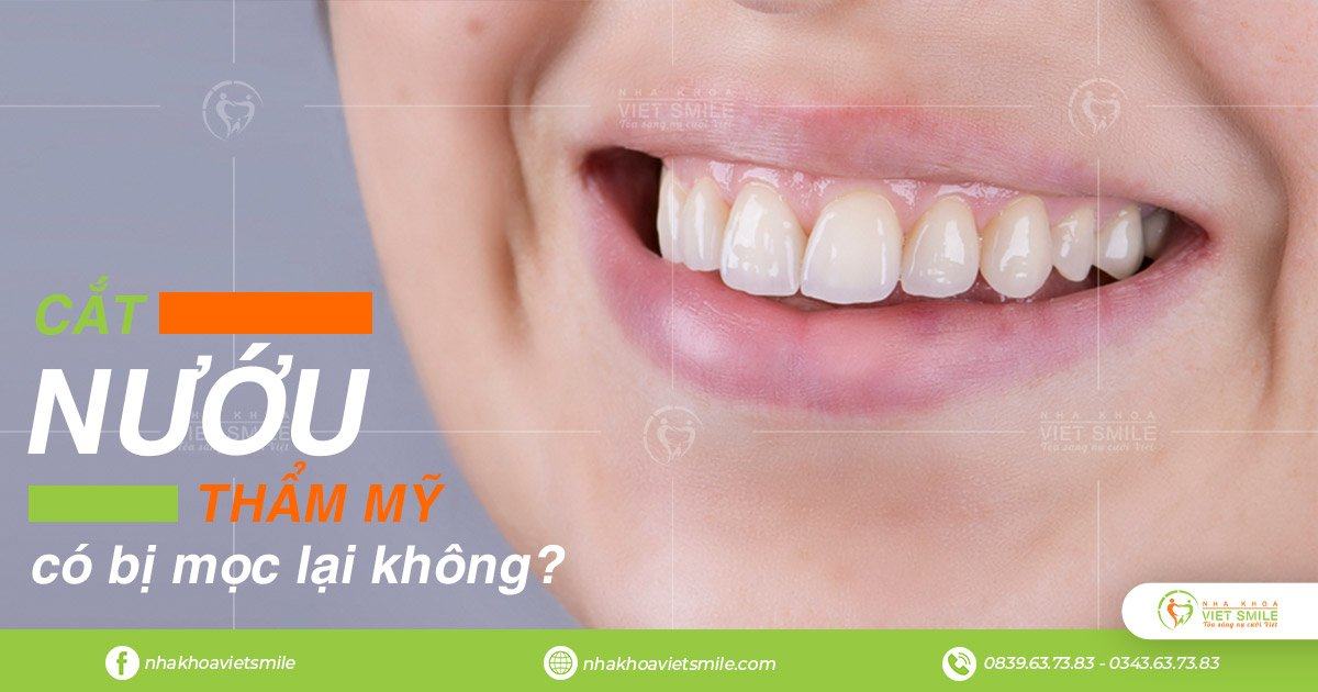 Vietsmile cat nuou tham my co bi moc lai khong