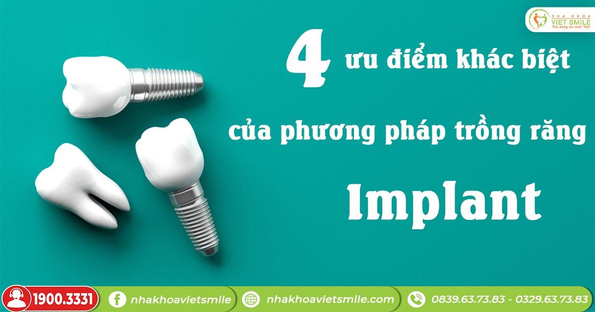 4 ưu diem khac biet cua phuong phap trong rang implant