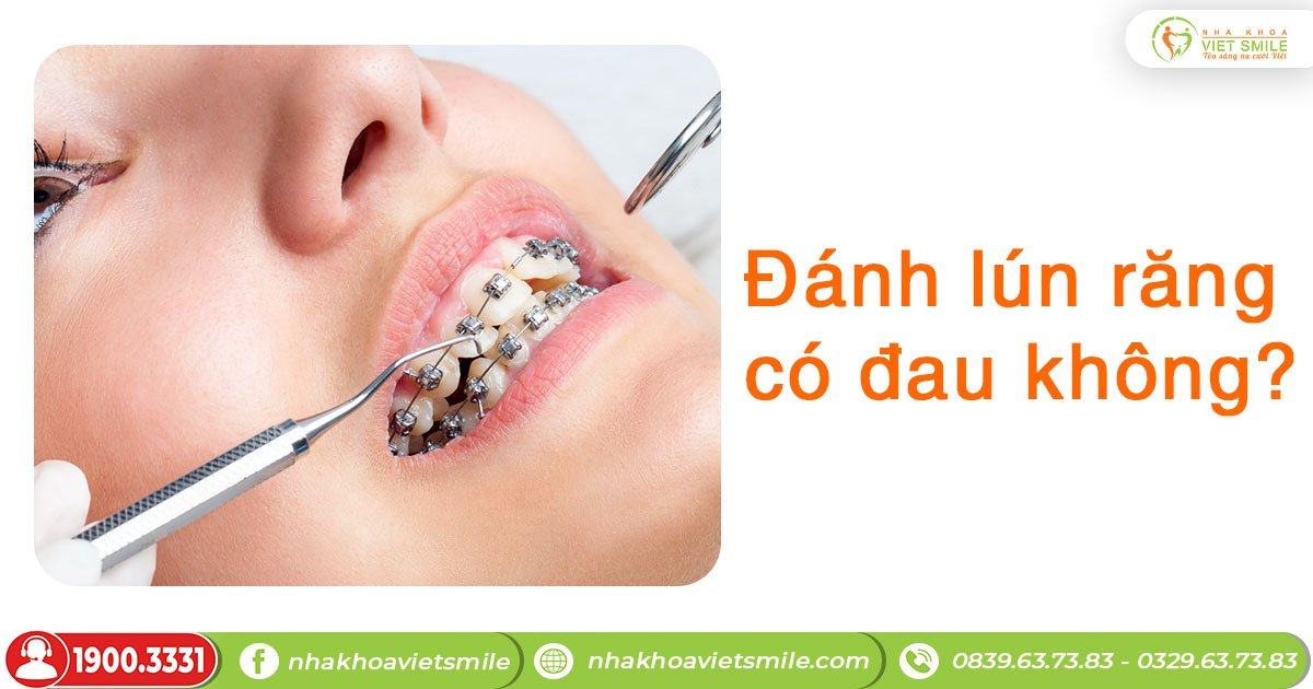 Đánh lún răng có đau không?