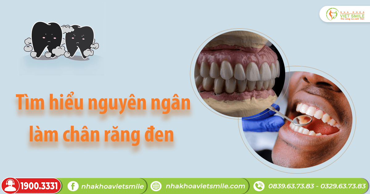 VietSmile Trị Cười Hở Lợi