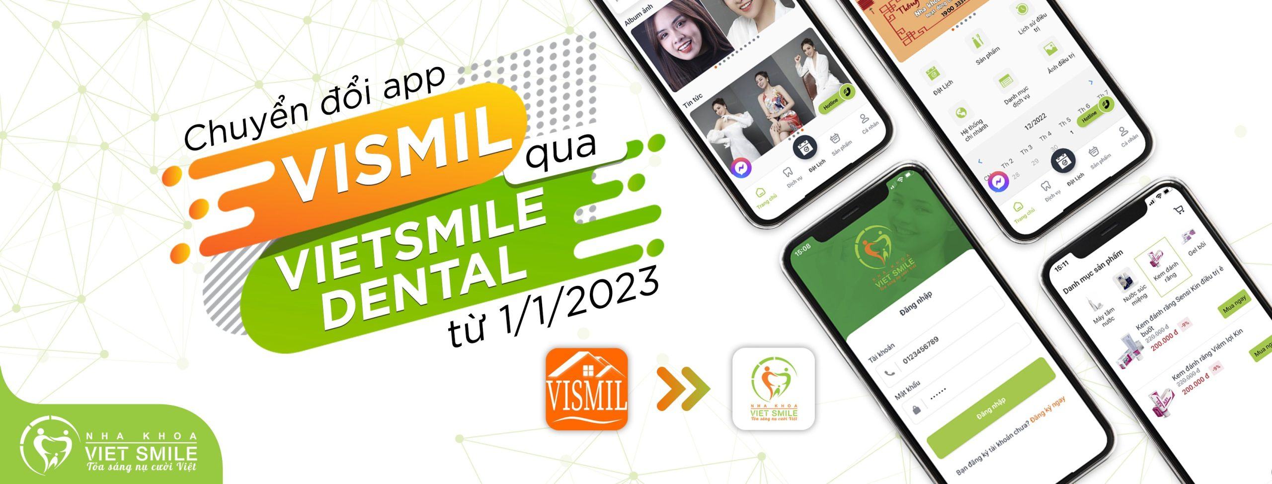 VietSmile Trị Cười Hở Lợi