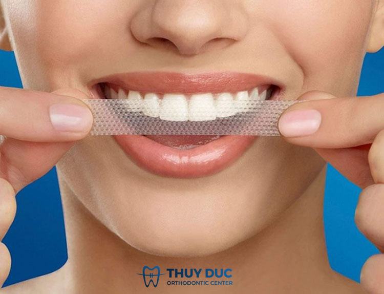 VietSmile Trị Cười Hở Lợi