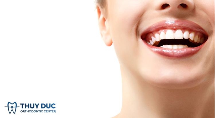 VietSmile Trị Cười Hở Lợi