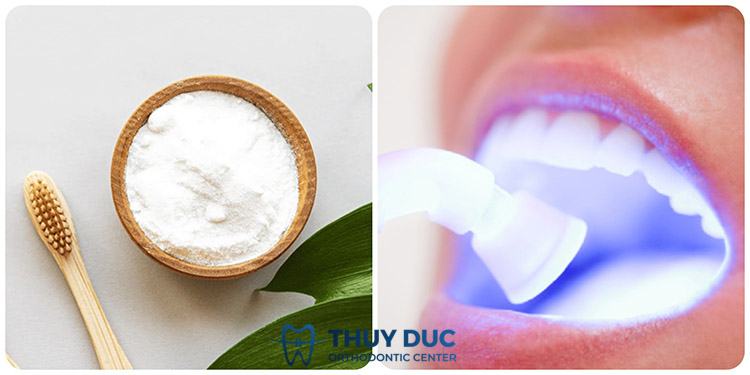 VietSmile Trị Cười Hở Lợi