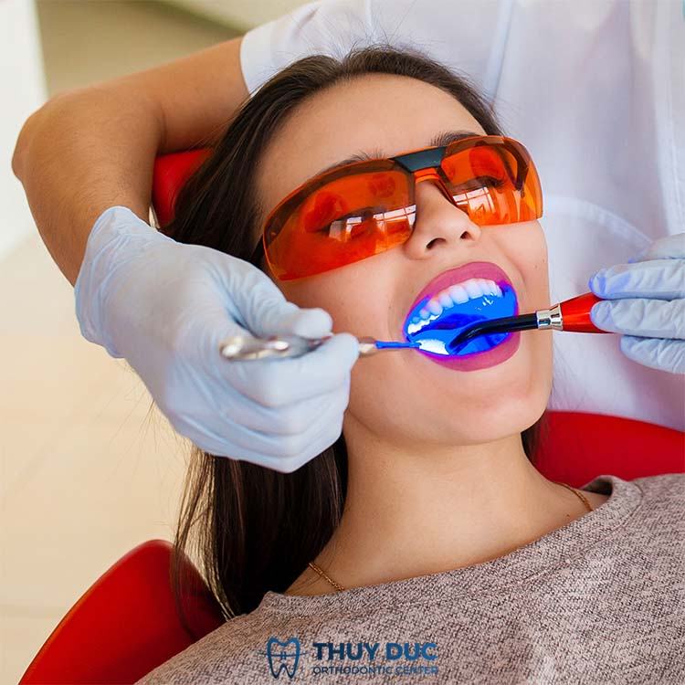 VietSmile Trị Cười Hở Lợi