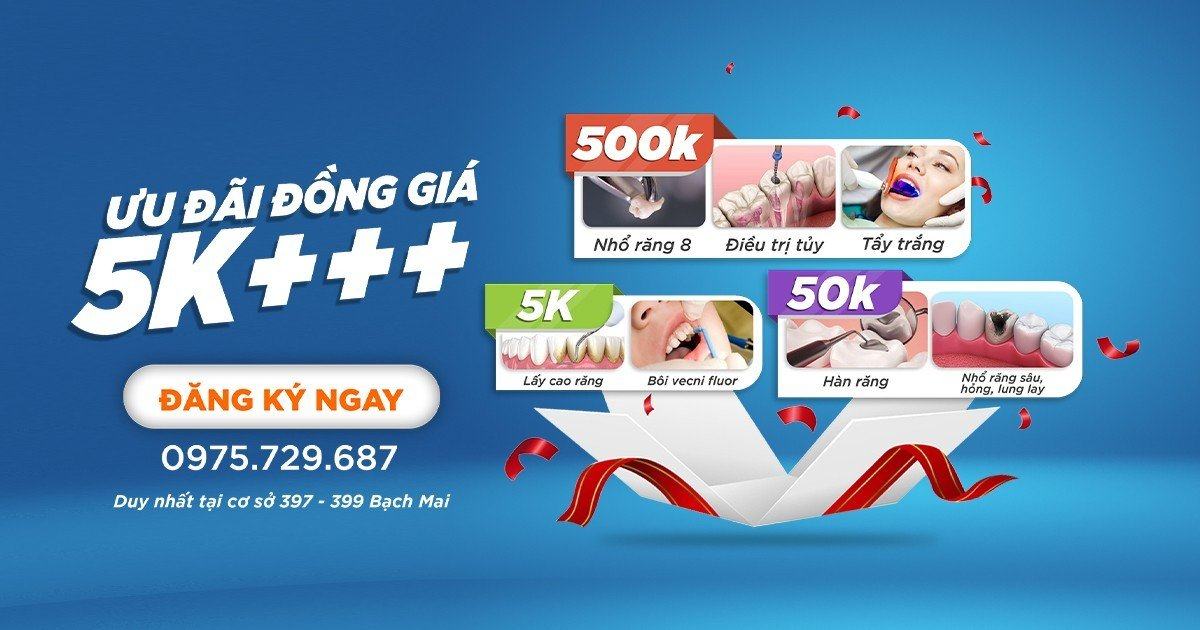 VietSmile Trị Cười Hở Lợi