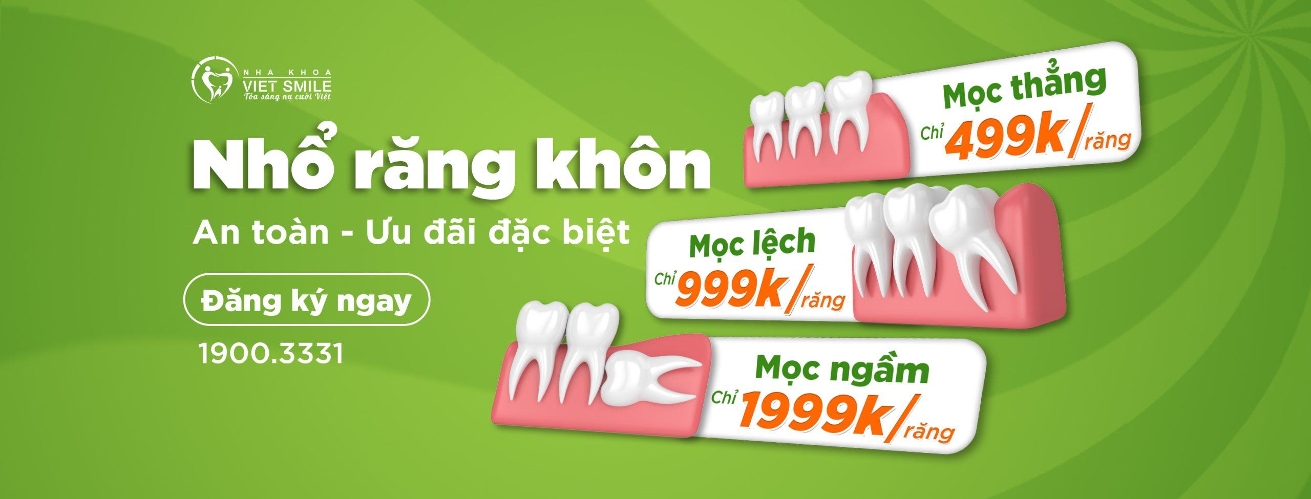 VietSmile Trị Cười Hở Lợi