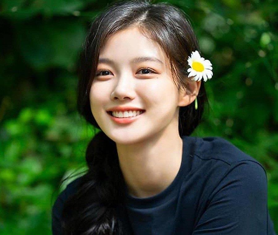 Diễn viên kim-yoo-jungkk cười hở 10 răng cực đẹp