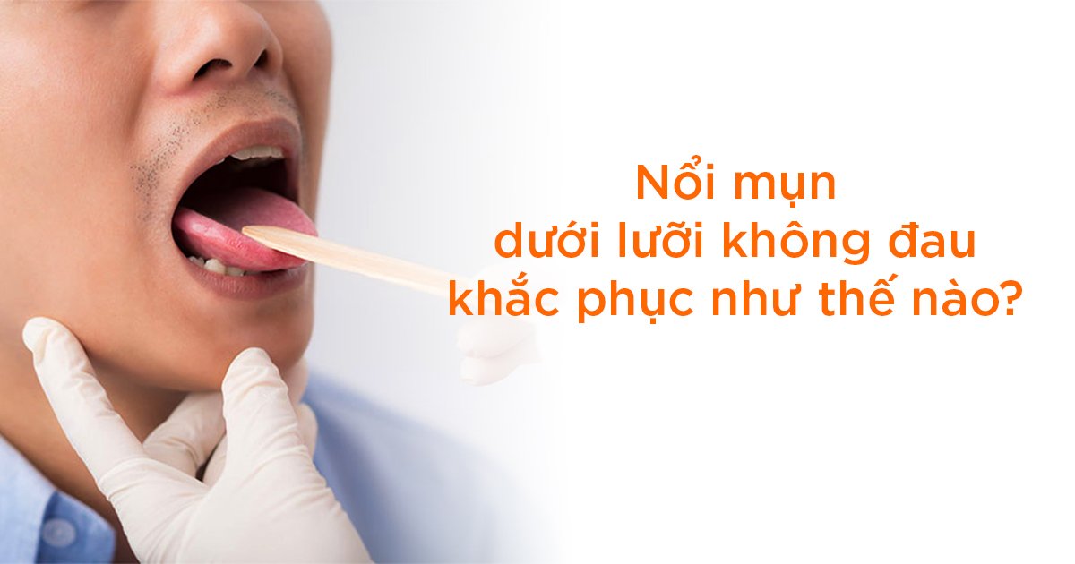 Nổi mụn dưới lưỡi không đau khắc phục như thế nào?