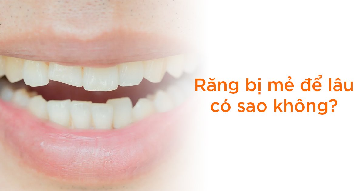 Răng bị mẻ để lâu có sao không?